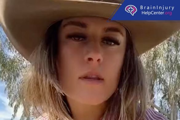 influencer sufre lesión en la cabeza