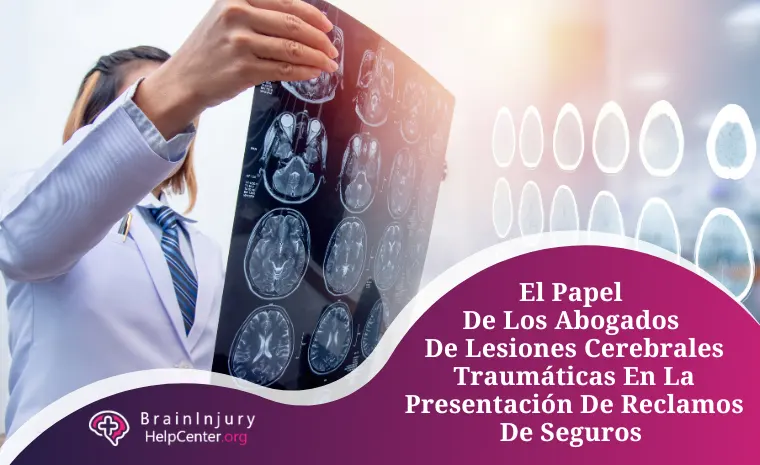 abogados de lesiones cerebrales traumáticas abogados de lesiones cerebrales traumáticas