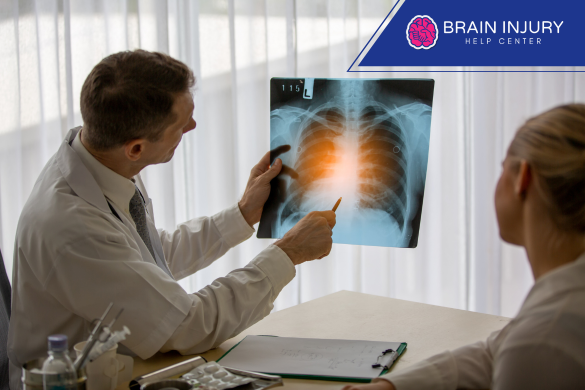 lesiones cerebrales graves