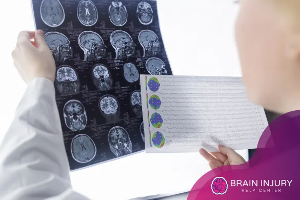 demandas por dolor y sufrimiento