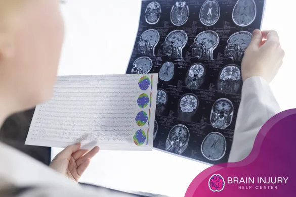 Los Angeles brain injury lawyer